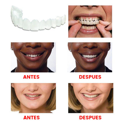 🦷Funda Dental😁¡COBERTURA DENTAL COMPLETA SIN PAGAR COSTOSOS PROCEDIMIENTOS ESTÉTICOS!